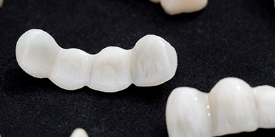 レジン前装冠（前歯のみ）