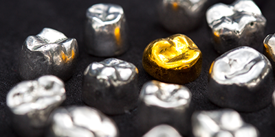 金銀パラジウム合金